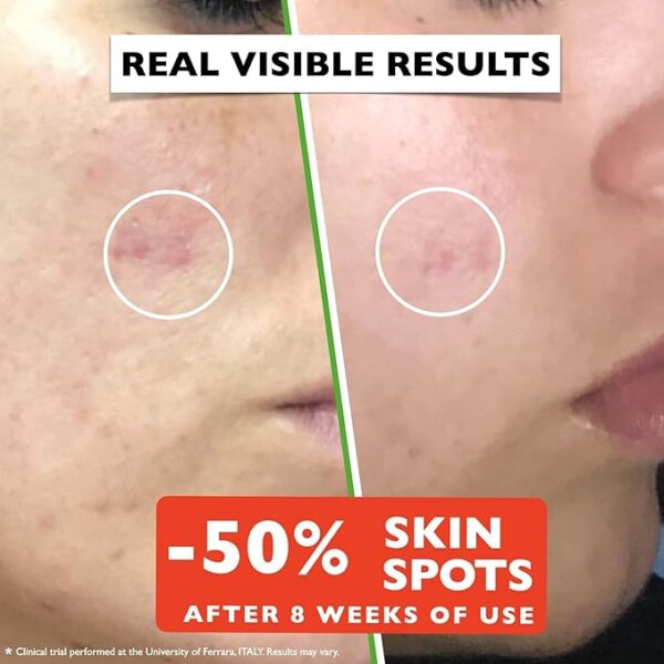 PRICE DROP SAVE UPTO 33% Vitamin C Serum For Face - Image 2